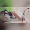 Installation of our PolyLevel injection